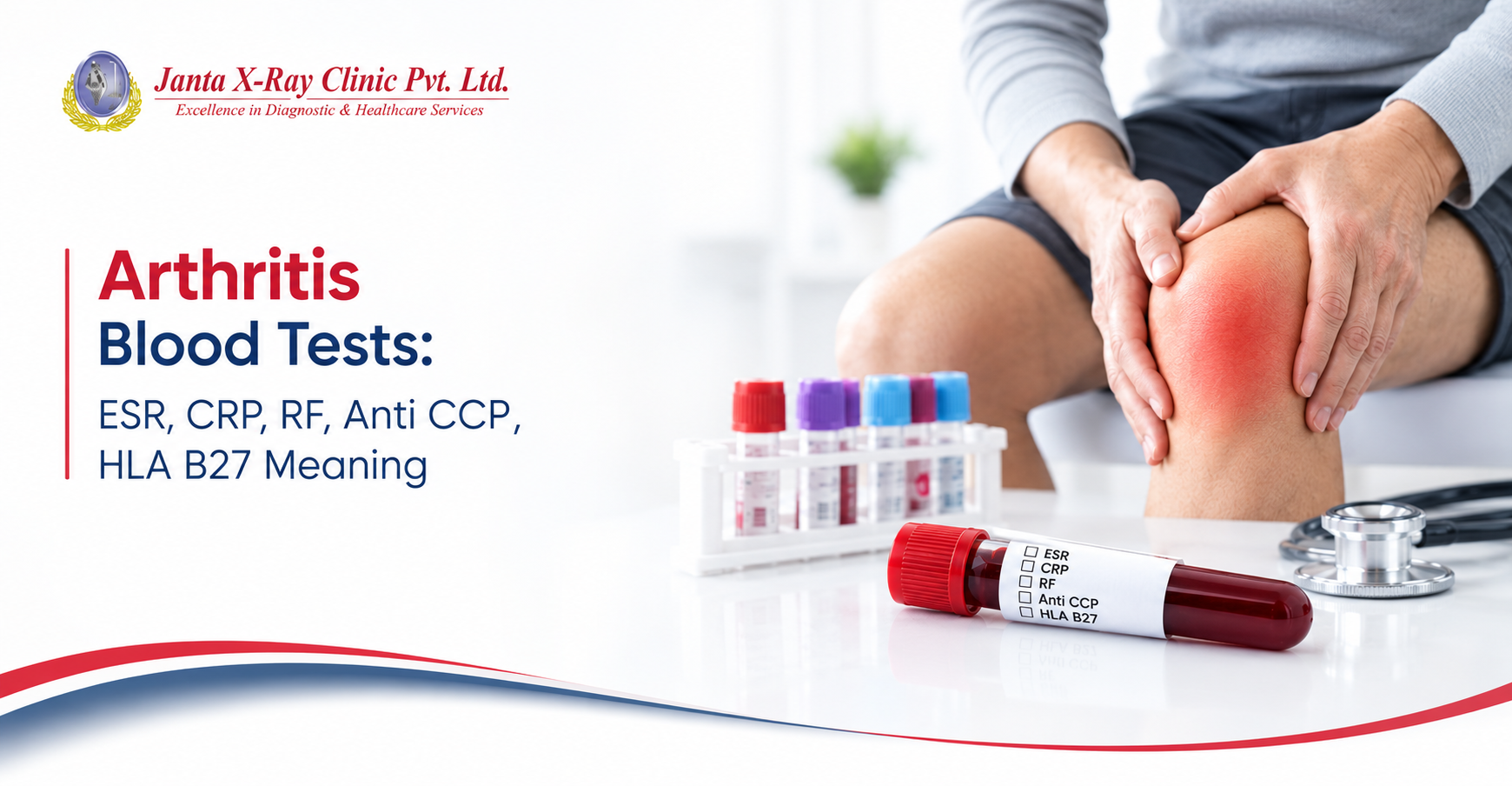 Joint Pain or Arthritis? What Your Blood Tests Really Mean