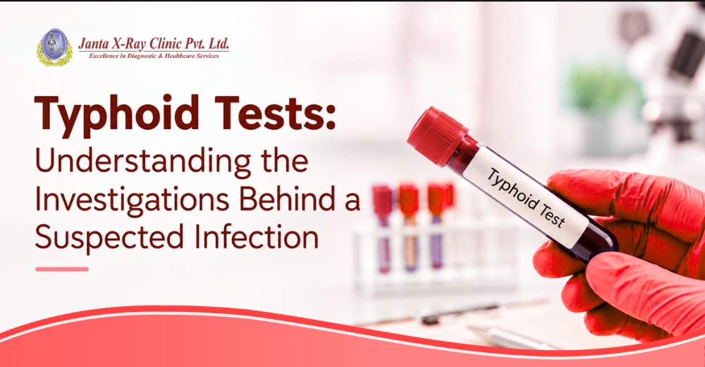 Typhoid Tests: Understanding the Investigations Behind a Suspected Infection
