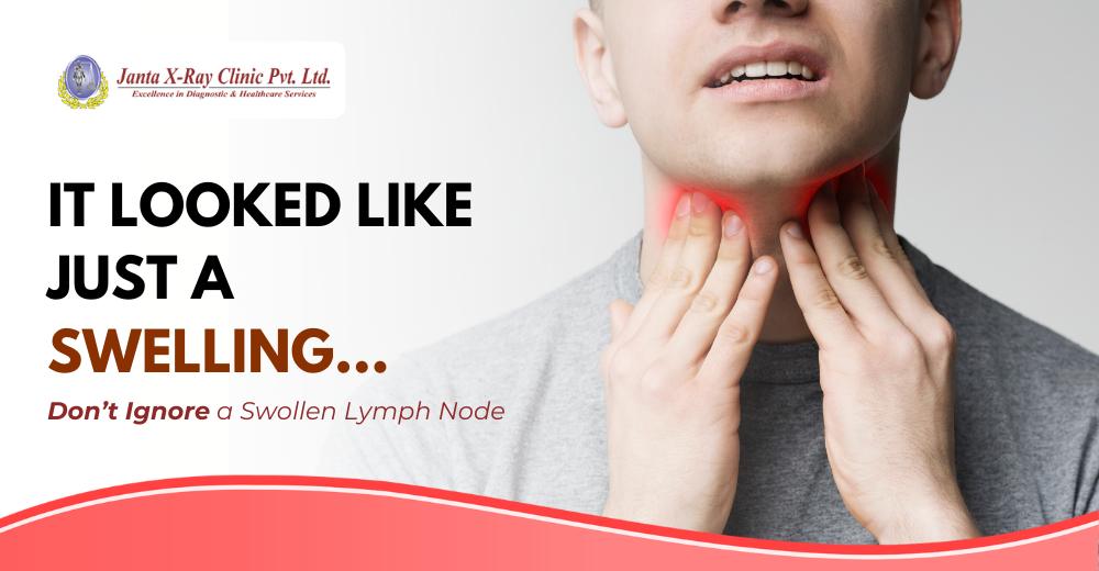 You Might Ignore a Swollen Lymph Node: Until FNAC Tells a Different Story