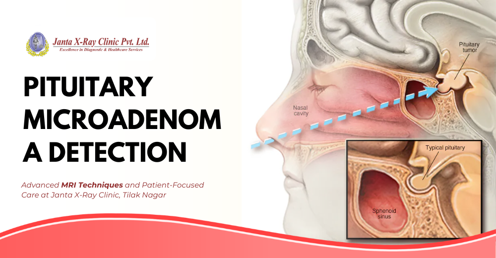 Pituitary Microadenoma Detection and Care at Janta X-Ray Clinic Pvt. Ltd Tilak Nagar