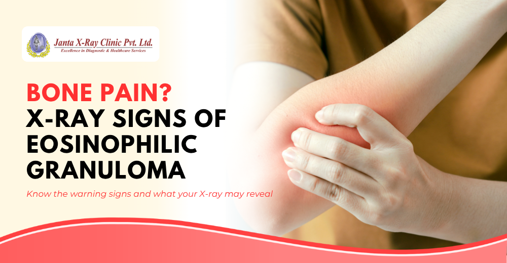 Eosinophilic Granuloma X-Ray Findings, Symptoms and Treatment Explained by Radiologist Dr. Varun Kumar
