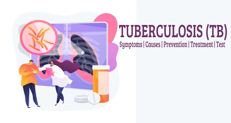 What Is Tuberculosis and Its Symptoms, Causes,  Treatment, Prevention, Test