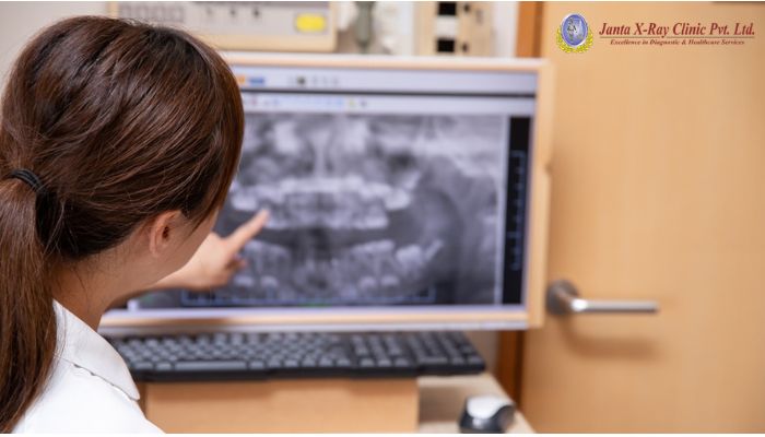 What Can A Digital X-Ray Detect?