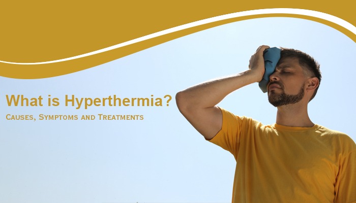 What is Hyperthermia: Causes, Symptoms and Treatments