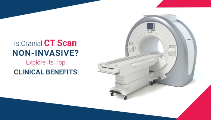 Is Cranial CT Scan Non-Invasive? Explore Its Top Clinical Benefits