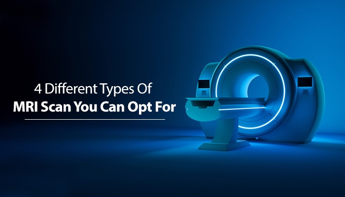 4 Different Types Of MRI Scan You Can Opt For